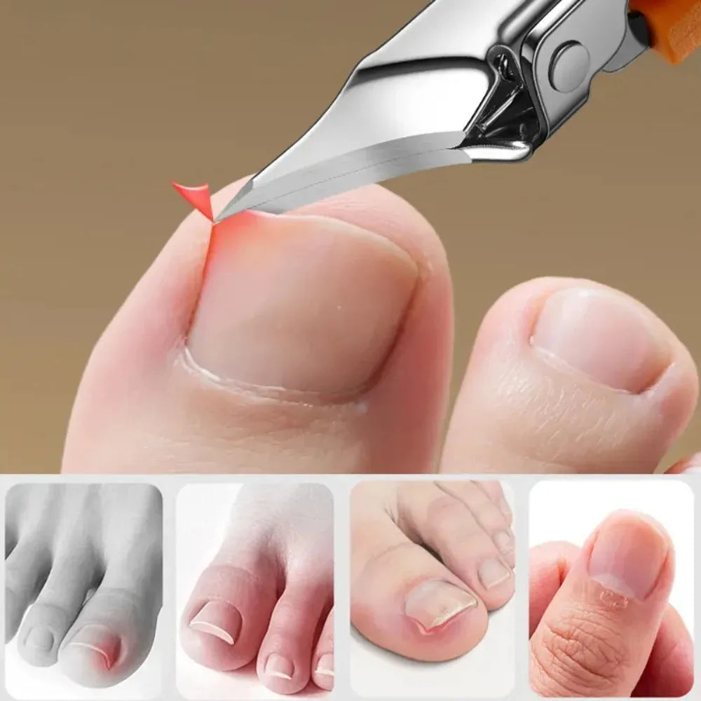 25 Degree Slant Edge Nail Clipper for Ingrown Toenails - Vaxicy